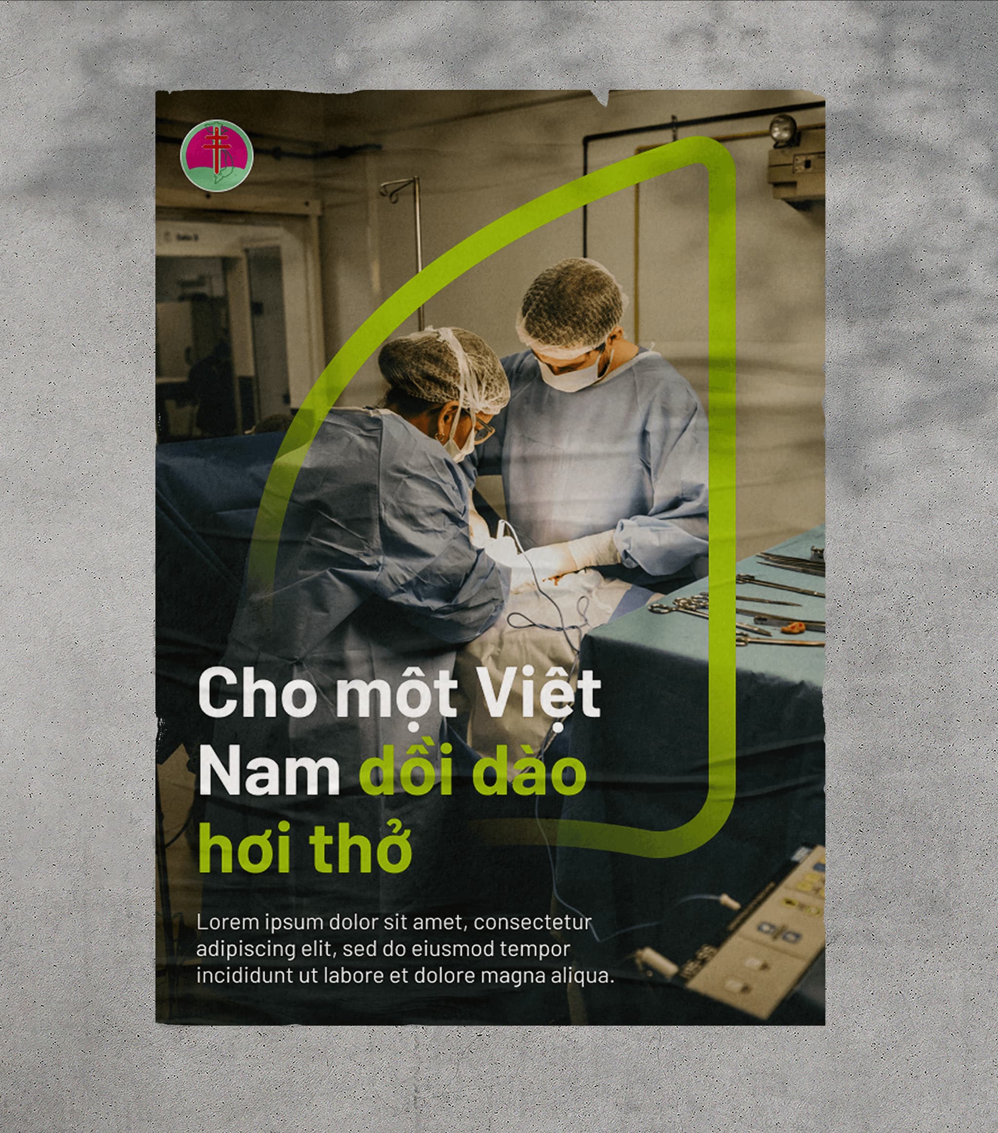 Medical professionals performing surgery with informative text in Vietnamese. Engaging design on a textured background.